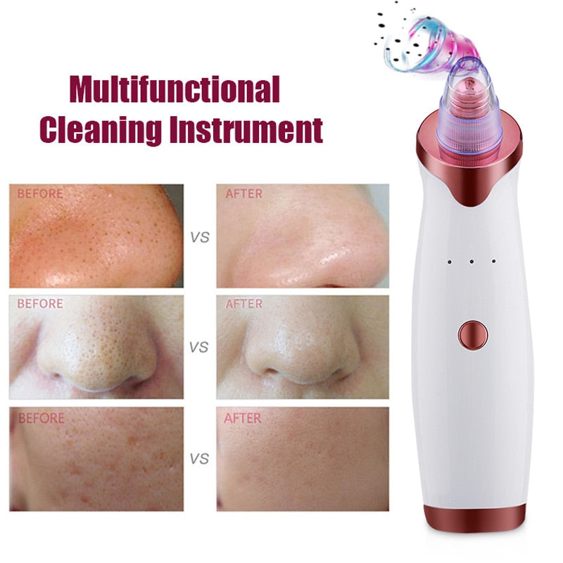 Blackhead Vacuum Extractor