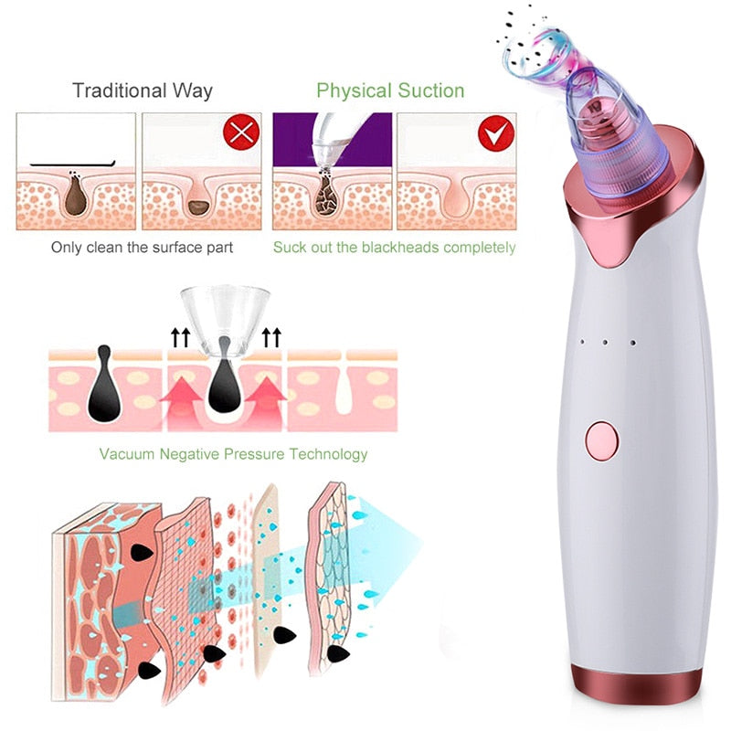 Blackhead Vacuum Extractor